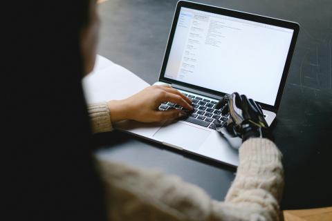 A Woman Using a Laptop With A Robotic Hand